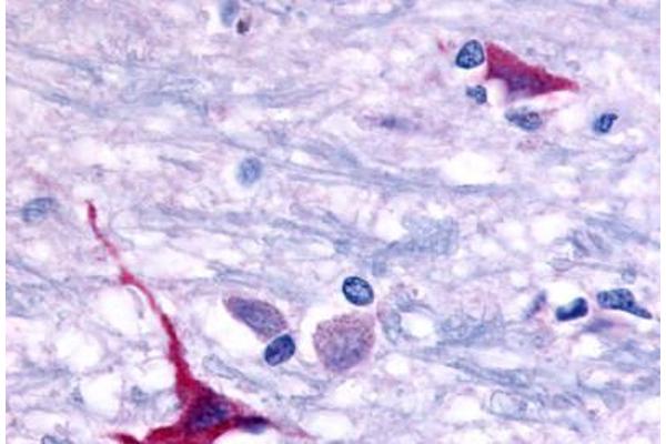 GPR101 antibody  (Cytoplasmic Domain)