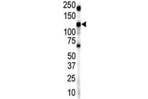Western blot analysis of Insulin receptor-related antibody and mouse brain lysate. (INSRR antibody  (AA 16-47))
