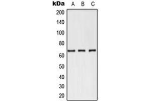Western blot analysis of CD62E expression in PC12 (A), NIH3T3 (B), Jurkat (C) whole cell lysates. (Selectin E/CD62e antibody  (N-Term))
