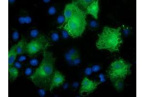 Immunofluorescence (IF) image for anti-Calcium Binding and Coiled-Coil Domain 2 (CALCOCO2) antibody (ABIN1497076) (CALCOCO2 antibody)
