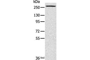 Western blot analysis of Huvec cell, using TLN1 Polyclonal Antibody at dilution of 1:200 (TLN1 antibody)