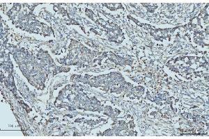 IHC analysis of Cytokeratin 5 using anti-Cytokeratin 5 antibody (ABIN7602992).