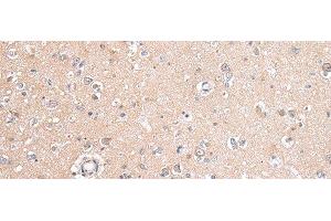 Immunohistochemistry of paraffin-embedded Human brain tissue using GJB5 Polyclonal Antibody at dilution 1:45 (GJB5 antibody)