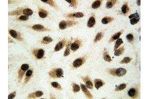 Anti-ERK1 antibody, IHC(P) ICC: HELA Cell (ERK1 antibody  (Middle Region))