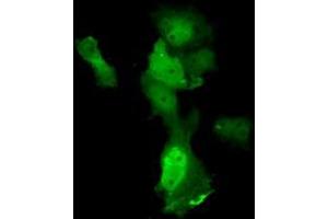 Anti-ANXA11 mouse monoclonal antibody (ABIN2452757) immunofluorescent staining of COS7 cells transiently transfected by pCMV6-ENTRY ANXA11 (RC212191). (Annexin A11 antibody)