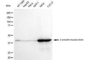 Western blotting analysis using alpha smooth muscle Actin antibody (ABIN7797465). (Recombinant Smooth Muscle Actin antibody)