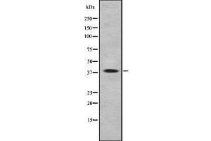 Western blot analysis of TAAR3 using COLO205 whole cell lysates (TAAR3 antibody)