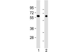 Western blot testing of human 1) kidney and 2) lung tissue lysate with MKS1 antibody at 1:2000.