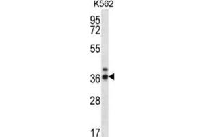 Western Blotting (WB) image for anti-Ribonuclease P/MRP 38kDa Subunit (RPP38) antibody (ABIN2996921) (RPP38 antibody)