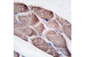 Image no. 2 for anti-Epilepsy, Progressive Myoclonus Type 2A, Lafora Disease (Laforin) (EPM2A) (C-Term) antibody (ABIN356954) (EPM2A antibody  (C-Term))
