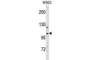 CC2D1A Antibody (N-term) western blot analysis in K562 cell line lysates (35µg/lane). (CC2D1A antibody  (N-Term))