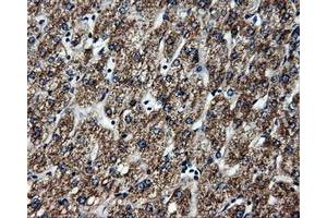 Immunohistochemical staining of paraffin-embedded liver tissue using anti-ATP5Bmouse monoclonal antibody. (ATP5B antibody)