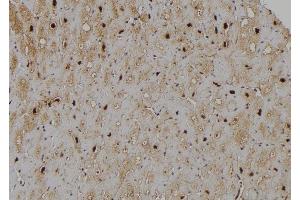 ABIN6277192 at 1/100 staining Human heart tissue by IHC-P.