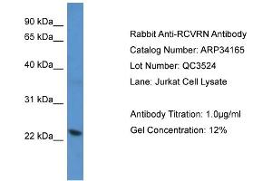 WB Suggested Anti-RCVRN Antibody   Titration: 1.