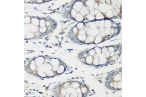 Immunohistochemistry of paraffin-embedded human colon using TNNC2 antibody at dilution of 1:200 (40x lens).