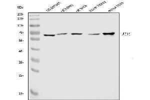 Western blot analysis of ATIC using anti-ATIC antibody (ABIN7601511). (ATIC antibody  (AA 37-592))
