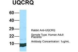Host: Rabbit  Target Name: UQCRQ  Sample Tissue: Human Adult Placenta  Antibody Dilution: 1.