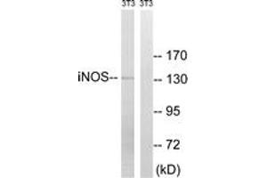 Western blot analysis of extracts from NIH-3T3 cells, using iNOS (Ab-151) Antibody.