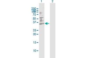 Western Blotting (WB) image for anti-Small Nuclear Ribonucleoprotein Polypeptide A (SNRPA) (AA 1-282) antibody (ABIN520345)