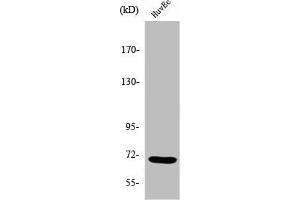 Western Blot analysis of COLO205 cells using Sam 68 Polyclonal Antibody (KHDRBS1 antibody  (Internal Region))