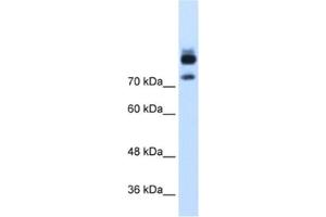 Western Blotting (WB) image for anti-Myotubularin Related Protein 1 (MTMR1) antibody (ABIN2462536) (MTMR1 antibody)