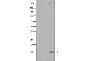 Western blot analysis of Interleukin 5 expression in HT-29 cells,The lane on the left is treated with the antigen-specific peptide. (IL-5 antibody  (Internal Region))