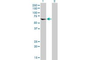 Western Blot analysis of VPS72 expression in transfected 293T cell line by VPS72 MaxPab polyclonal antibody.