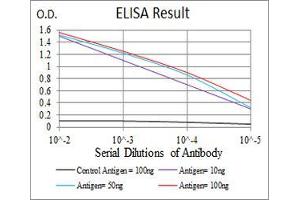 Black line: Control Antigen (100 ng), Purple line: Antigen(10 ng), Blue line: Antigen (50 ng), Red line: Antigen (100 ng), (ATG5 antibody)