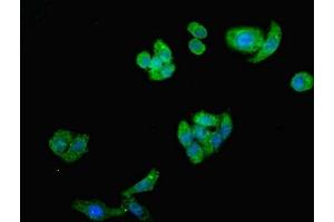 Immunofluorescent analysis of HepG2 cells using ABIN7143802 at dilution of 1:100 and Alexa Fluor 488-congugated AffiniPure Goat Anti-Rabbit IgG(H+L) (ST8SIA2 antibody  (AA 24-160))