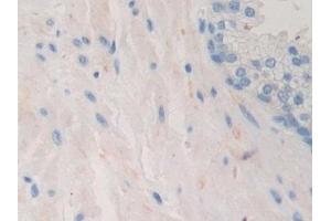 Detection of PDHX in Human Prostate Tissue using Polyclonal Antibody to Pyruvate Dehydrogenase Complex Component X (PDHX)