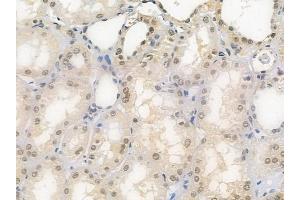 ABIN6258035 and ABIN6275789 at 1/100 staining human normal kidney tissue by IHC-P.