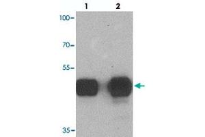Western blot analysis of TUBA3C in mouse brain tissue with TUBA3C polyclonal antibody  at (lane 1) 0.