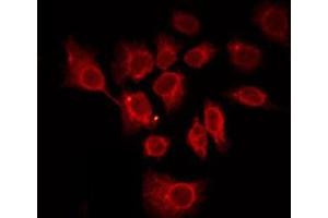 ABIN6276003 staining LOVO by IF/ICC. (GPR113 antibody  (N-Term))