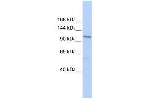TRPC3 antibody used at 1 ug/ml to detect target protein. (TRPC3 antibody  (N-Term))