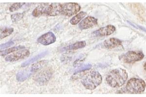 Immunohistochemistry (IHC) image for anti-Ataxia Telangiectasia Mutated (ATM) (AA 2550-2600) antibody (ABIN7448423) (ATM antibody  (AA 2550-2600))