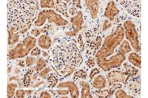 IHC testing of FFPE human kidney tissue with Arginase 1 antibody. (Liver Arginase antibody)