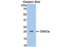 Western Blotting (WB) image for anti-Apolipoprotein B (APOB) (AA 3360-3526) antibody (ABIN1715286) (APOB antibody  (AA 3360-3526))
