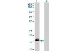 Western Blot analysis of CALM3 expression in transfected 293T cell line by CALM3 MaxPab polyclonal antibody. (Calmodulin 3 antibody  (AA 1-149))