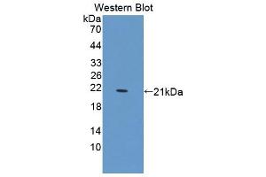 Figure. (PTPN13 antibody  (AA 1-161))