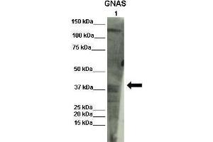 Lanes :  Lane 1: INS1 lysate   Primary Antibody Dilution :   1:1000    Secondary Antibody :  Donkey anti-rabbit-HRP   Secondary Antibody Dilution :   1:1000   Gene Name :  GNAS   Submitted by :  Olivier Costa, Diabetes research center VUB (GNAS antibody  (N-Term))