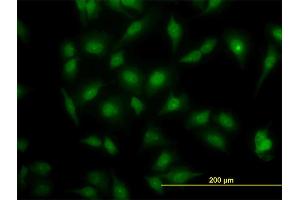 Immunofluorescence of monoclonal antibody to MAPK3 on HeLa cell. (ERK1 antibody  (AA 279-379))