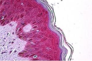 Human Skin: Formalin-Fixed, Paraffin-Embedded (FFPE) (TRIM29 antibody  (AA 295-306))