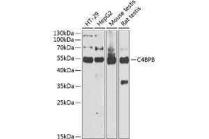 Western blot analysis of extracts of various cell lines, using C4BPB antibody (ABIN6127735, ABIN6137775, ABIN6137776 and ABIN6221978) at 1:1000 dilution.