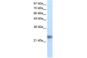 WB Suggested Anti-ZNF313 Antibody Titration: 1. (RNF114 antibody  (N-Term))