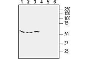 Western blot analysis of human SH-SY5Y neuroblastoma (lanes 1 and 4), human HT-29 colon adenocarcinoma (lanes 2 and 5) and human MCF-7 breast adenocarcinoma (lanes 3 and 6) cell line lysates: - 1-3. (NETO2 antibody  (Extracellular, N-Term))