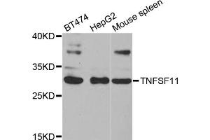 Western blot analysis of extracts of various cell lines, using TNFSF11 antibody (ABIN5971376) at 1/1000 dilution.