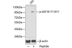 Western blot analysis of extracts from 293 cells, using Phospho-IGF1R-Y1161 antibody (ABIN3020252, ABIN3020253, ABIN3020254 and ABIN1681673). (IGF1R antibody  (pTyr1161))