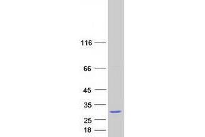Validation with Western Blot (TRPT1 Protein (Transcript Variant 2) (Myc-DYKDDDDK Tag))