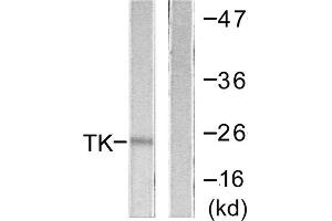 Western blot analysis of extracts from COLO205 cells, using TK (epitope around residue 13) antibody. (TK (N-Term), (Ser13) antibody)