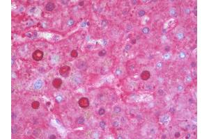 Anti-SERPINA1 / Alpha 1 Antitrypsin antibody IHC staining of human liver.